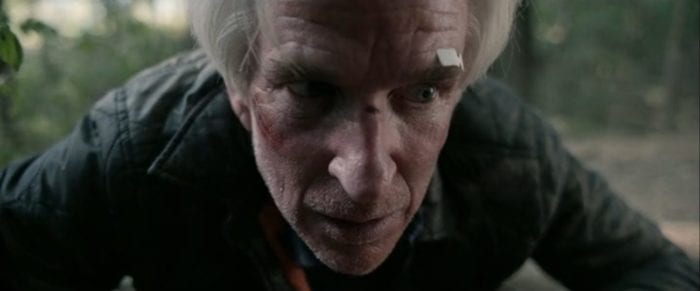 Scott lies on the ground looking nervously at the camera, his face is cut up and a bandage is present over his left eye.