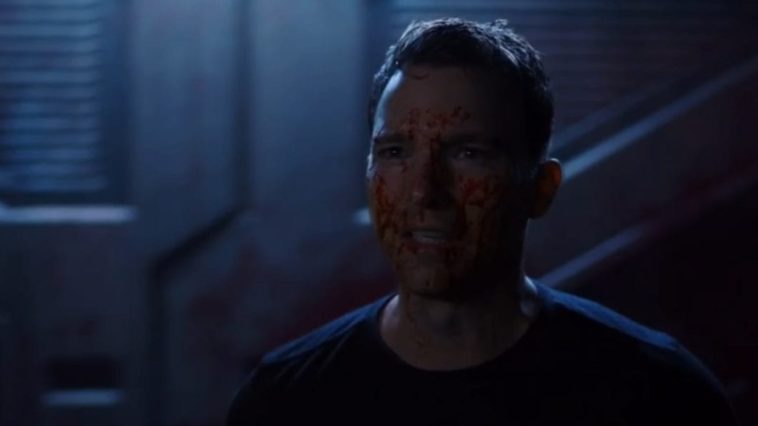 Zeller face is covered in blood