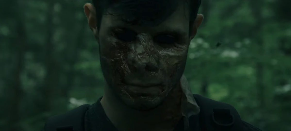 a boy's face scarred and with blackened eyes in The Long Dark Trail