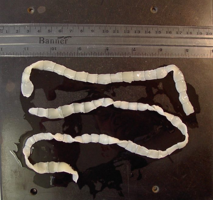 A removed tapeworm on a table