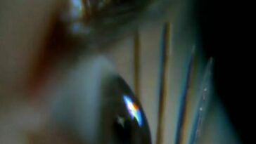Extreme closeup of Betty's eyeball as the needles are taped to her face