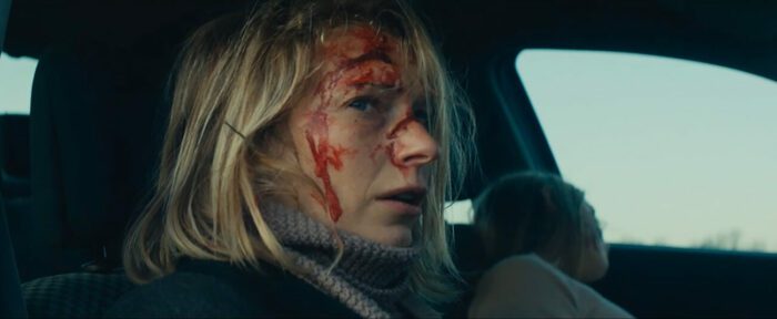 A woman with blood on her face