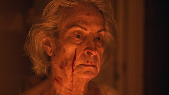 An elderly woman with blood on her face